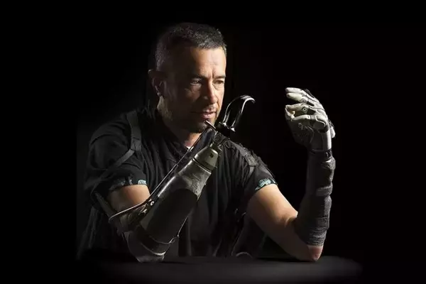 Bridging the Gap: AI Enhances Bionic Hand Functionality for Amputees