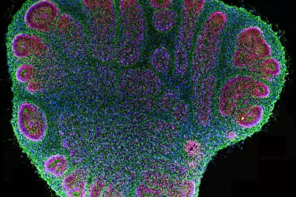 Brain Organoids: Advancements and Ethical Complexities in Neural Research