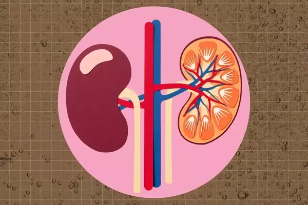 The Impact of Dark Sodas on Kidney Health