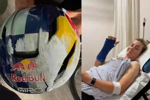 The Indispensable Lifesaving Role of Helmets in Cycling: Zoe Bäckstedt's Harrowing Experience