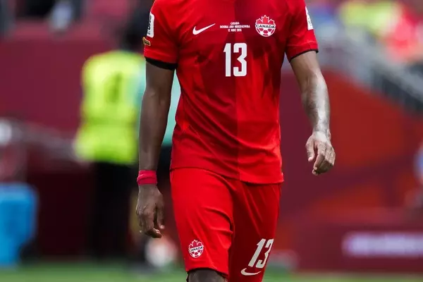 Frosted Tips: The Unexpected Hair Trend Dominating the World Cup