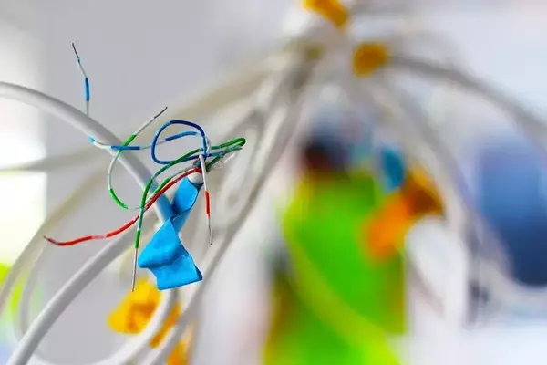 Nano Dimension Updates on Infinite Epigenetics Merger