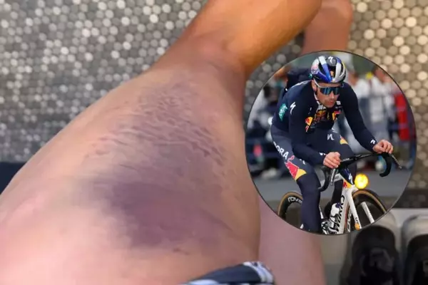 Primož Roglič Suffers Injury in Training Accident, Threatening Vuelta a España Participation