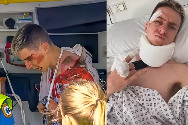 Pogačar Undergoes Successful Collarbone Surgery, Return to Racing Uncertain